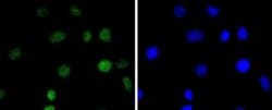 IRF2 Antibody (JJ088-0), Novus Biologicals 100&mu;L:Antibodies, Monoclonal