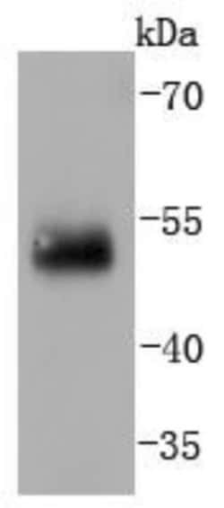 IRF2 Antibody (JJ088-0), Novus Biologicals 100&mu;L:Antibodies, Monoclonal