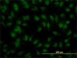IRF2 Antibody (3B5), Novus Biologicals 0.1 mg | Buy Online | Novus Biologicals | Fisher Scientific
