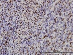 IRF2 Antibody (3B5), Novus Biologicals 0.1 mg | Buy Online | Novus Biologicals | Fisher Scientific