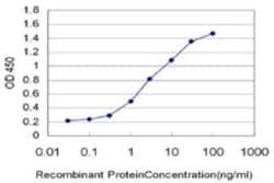 IRF2 Antibody (7C2), Novus Biologicals 0.1 mg, Unconjugated:Anticuerpos
