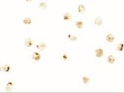 IRF2BP2 Antibody - BSA Free, Novus Biologicals 0.1 mg; Unconjugated:Antibodies,