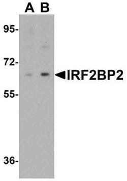 IRF2BP2 Antibody - BSA Free, Novus Biologicals 0.1 mg; Unconjugated:Antibodies,