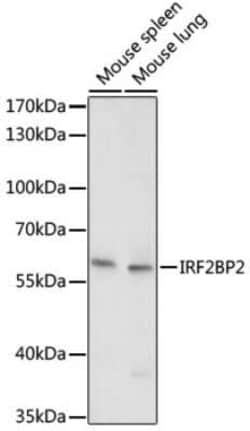 IRF2BP2 Antibody - Azide and BSA Free, Novus Biologicals 0.02 mL; Unconjugated:Antibodies,