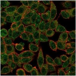 IRF3 Mouse anti-Human, Clone: PCRP-IRF3-3B2, Novus Biologicals 20 &mu;g;