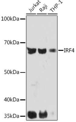 IRF4 Rabbit anti-Human, Clone: 2U3G10, Novus Biologicals 100 &mu;g | Buy Online | Novus Biologicals | Fisher Scientific