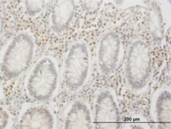 IRF4 Antibody (2F2), Novus Biologicals 0.1 mg | Buy Online | Novus Biologicals | Fisher Scientific