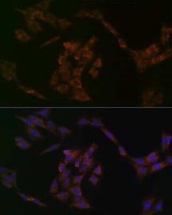 IRF6 Rabbit anti-Human, Mouse, Rat, Clone: 5D1Z4, Novus Biologicals 100 &mu;g | Buy Online | Novus Biologicals | Fisher Scientific