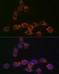 IRF6 Rabbit anti-Human, Mouse, Rat, Clone: 5D1Z4, Novus Biologicals 100 &mu;g | Buy Online | Novus Biologicals | Fisher Scientific