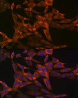 IRF6 Rabbit anti-Human, Mouse, Rat, Clone: 5D1Z4, Novus Biologicals 100 &mu;g | Buy Online | Novus Biologicals | Fisher Scientific