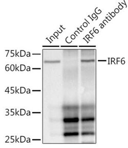 IRF6 Rabbit anti-Human, Mouse, Rat, Clone: 5D1Z4, Novus Biologicals 100 &mu;g | Buy Online | Novus Biologicals | Fisher Scientific