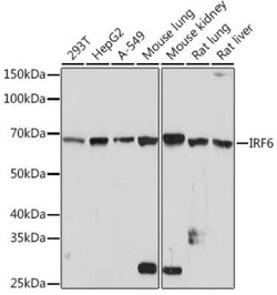 IRF6 Rabbit anti-Human, Mouse, Rat, Clone: 5D1Z4, Novus Biologicals 100 &mu;g | Buy Online | Novus Biologicals | Fisher Scientific