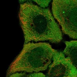 IRF6 Antibody, Novus Biologicals 25 &mu;L, Unconjugated:Antibodies, Polyclonal