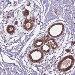 IRF6 Antibody, Novus Biologicals 25 &mu;L, Unconjugated:Antibodies, Polyclonal