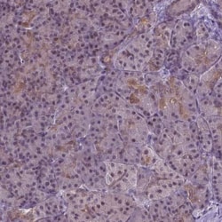 IRF6 Antibody, Novus Biologicals 25 &mu;L, Unconjugated:Antibodies, Polyclonal