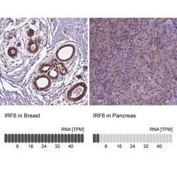 IRF6 Antibody, Novus Biologicals 25 &mu;L, Unconjugated:Antibodies, Polyclonal