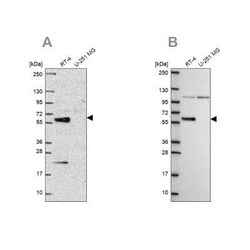 IRF6 Antibody, Novus Biologicals 25 &mu;L, Unconjugated:Antibodies, Polyclonal