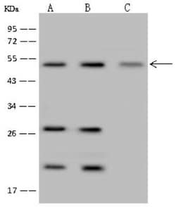 IRF6 Antibody, Novus Biologicals 100 &mu;g | Buy Online | Novus Biologicals | Fisher Scientific