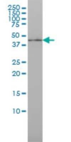 Novus Biologicals IRF9 Antibody (1D11), Novus Biologicals 0.1 mg | Buy Online | Novus Biologicals&trade; | Fisher Scientific