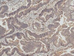 IRGM Antibody, Novus Biologicals 100 &mu;g | Buy Online | Bio-Techne | Fisher Scientific