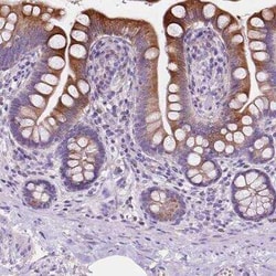 IRP2 Antibody, Novus Biologicals:Antibodies:Primary Antibodies