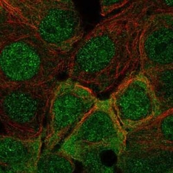 IRS1 Antibody, Novus Biologicals:Antibodies:Primary Antibodies