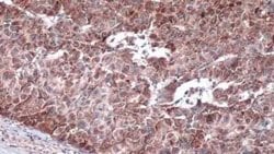 IRS4 Antibody, Novus Biologicals 100 μg; Unconjugated:Antibodies, Polyclonal