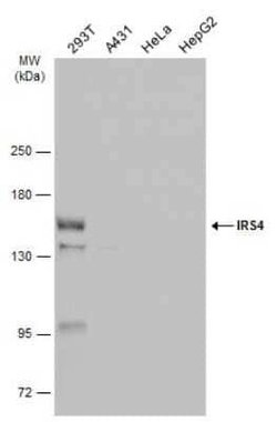 IRS4 Antibody, Novus Biologicals 100 μg; Unconjugated:Antibodies, Polyclonal