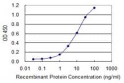 IRX6 Antibody (1A5), Novus Biologicals 0.1 mg; Unconjugated:Antibodies,
