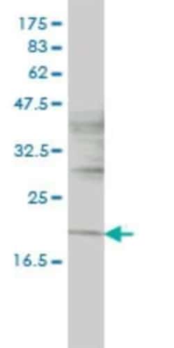 Novus Biologicals ISCU Antibody (3B8-1C4), Novus Biologicals 0.1 mg | Buy Online | Novus Biologicals&trade; | Fisher Scientific