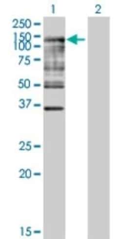 ISG15 Activating Enzyme/UBE1L Antibody, Novus Biologicals 0.05 mg | Buy Online | Novus Biologicals | Fisher Scientific