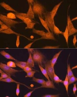 ISG15/UCRP Rabbit anti-Human, Mouse, Rat, Clone: ARC53794, Novus Biologicals:Antibodies:Primary