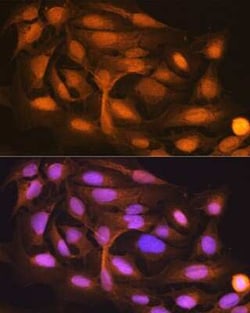 ISG15/UCRP Rabbit anti-Human, Mouse, Rat, Clone: ARC53794, Novus Biologicals:Antibodies:Primary