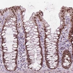 ISLR-2 Antibody, Novus Biologicals:Antibodies:Primary Antibodies