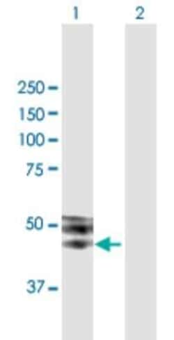 Novus Biologicals ISLR Antibody, Novus Biologicals 0.05 mg, Unconjugated:Antibodies,