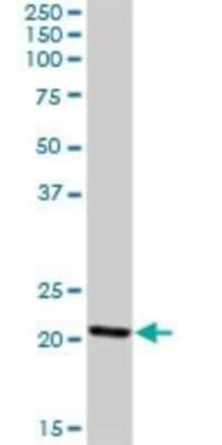 ISOC2 Antibody, Novus Biologicals 0.05 mg; Unconjugated:Antibodies, Polyclonal