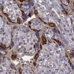 ISYNA1 Antibody, Novus Biologicals:Antibodies:Primary Antibodies