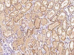 ITIH3 Antibody, Novus Biologicals:Antibodies:Primary Antibodies