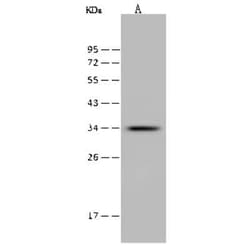 ITM2A Antibody, Novus Biologicals 100 &mu;g; Unconjugated:Antibodies, Polyclonal