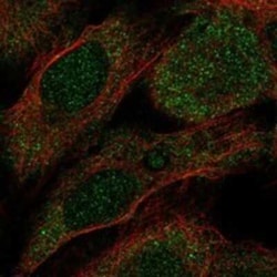 ITPA Rabbit anti-Human, Polyclonal, Novus Biologicals 25 &mu;g; Unconjugated:Antibodies,