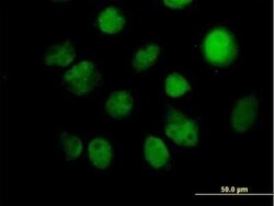 ITPK1 Antibody, Novus Biologicals 0.05 mg | Buy Online | Novus Biologicals | Fisher Scientific