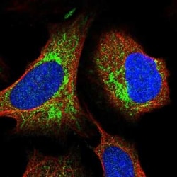 ITPK1 Antibody, Novus Biologicals 25 &mu;L, Unconjugated:Antibodies, Polyclonal