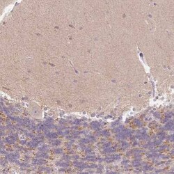 ITPK1 Antibody, Novus Biologicals 25 &mu;L, Unconjugated:Antibodies, Polyclonal