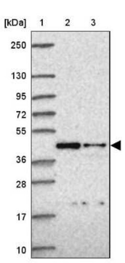ITPK1 Antibody, Novus Biologicals 25 &mu;L, Unconjugated:Antibodies, Polyclonal