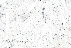 ITPR2 Antibody, Novus Biologicals 100 &mu;g; Unconjugated:Antibodies, Polyclonal