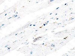 ITPR2 Antibody, Novus Biologicals 100 &mu;g; Unconjugated:Antibodies, Polyclonal