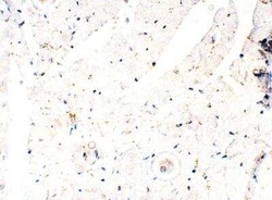 ITPR2 Antibody, Novus Biologicals 100 &mu;g; Unconjugated:Antibodies, Polyclonal
