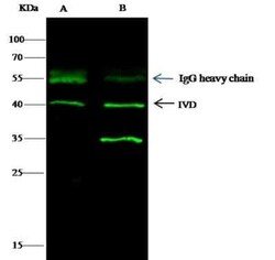 IVD Antibody (04), Novus Biologicals 100 &mu;g; Unconjugated:Antibodies,
