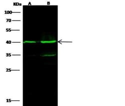IVD Antibody (04), Novus Biologicals 100 &mu;g; Unconjugated:Antibodies,