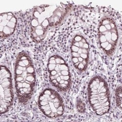 IWS1 Antibody, Novus Biologicals:Antibodies:Primary Antibodies